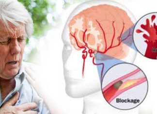 Cegah Stroke dengan Squalene